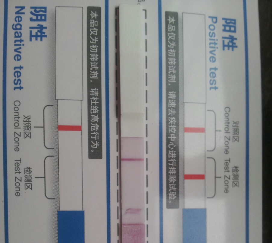 艾滋试纸现在被广泛的应用医疗机构