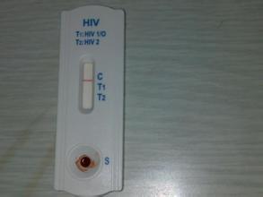 告诉大家怎么知道有没有感染艾滋病 告诉大家怎么知道有没有感染艾滋病