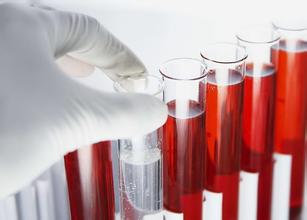 血常规可以检查出艾滋病吗？